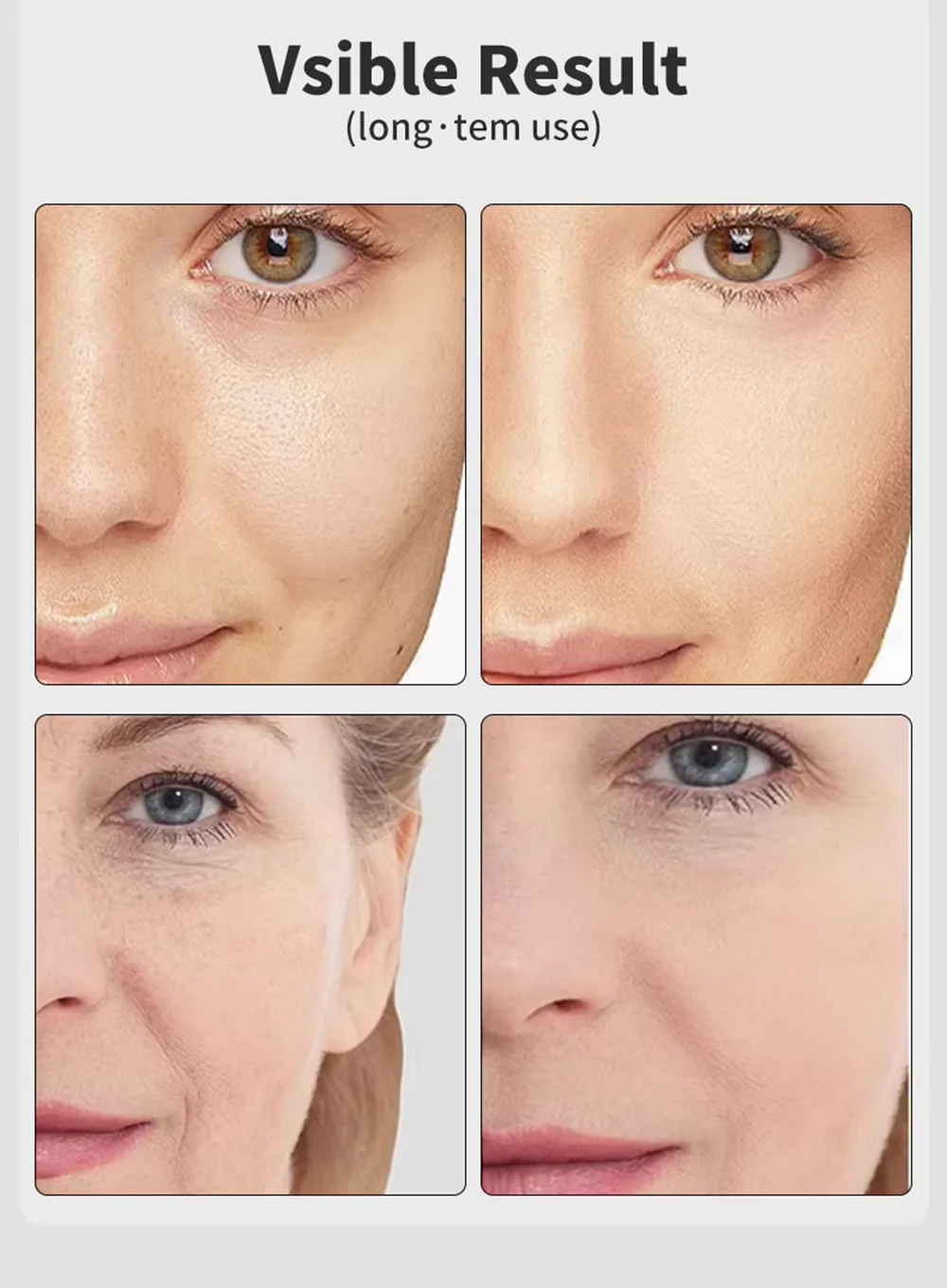 Age‑R Booster Pro™ — L’anti‑âge pro que ta peau attend