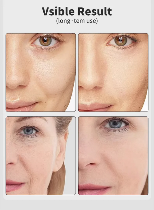 Age‑R Booster Pro™ — L’anti‑âge pro que ta peau attend